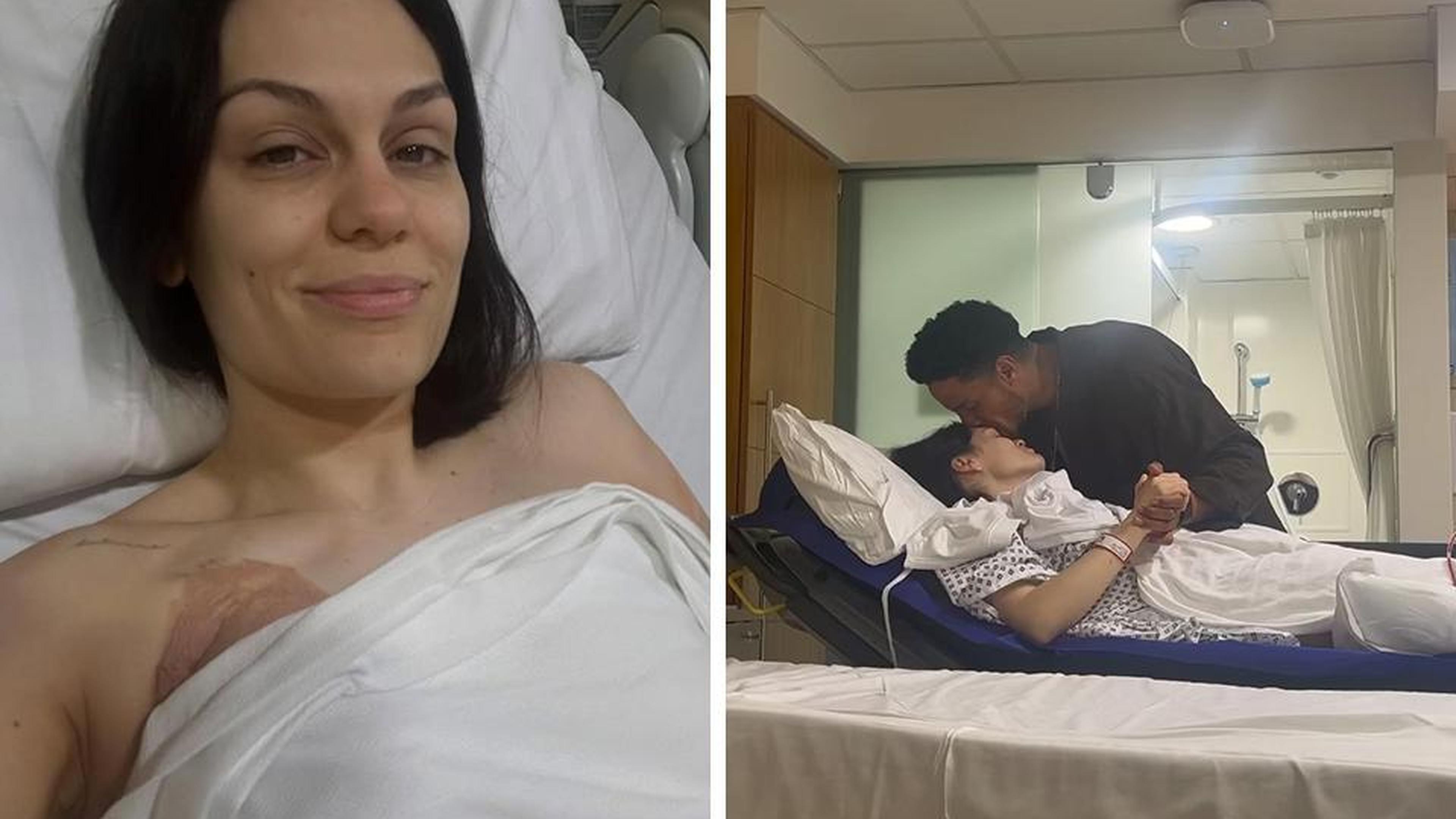 Zangeres Jessie J (37) ondergaat operatie na diagnose borstkanker: “Ik ben mijn dokters heel dankbaa