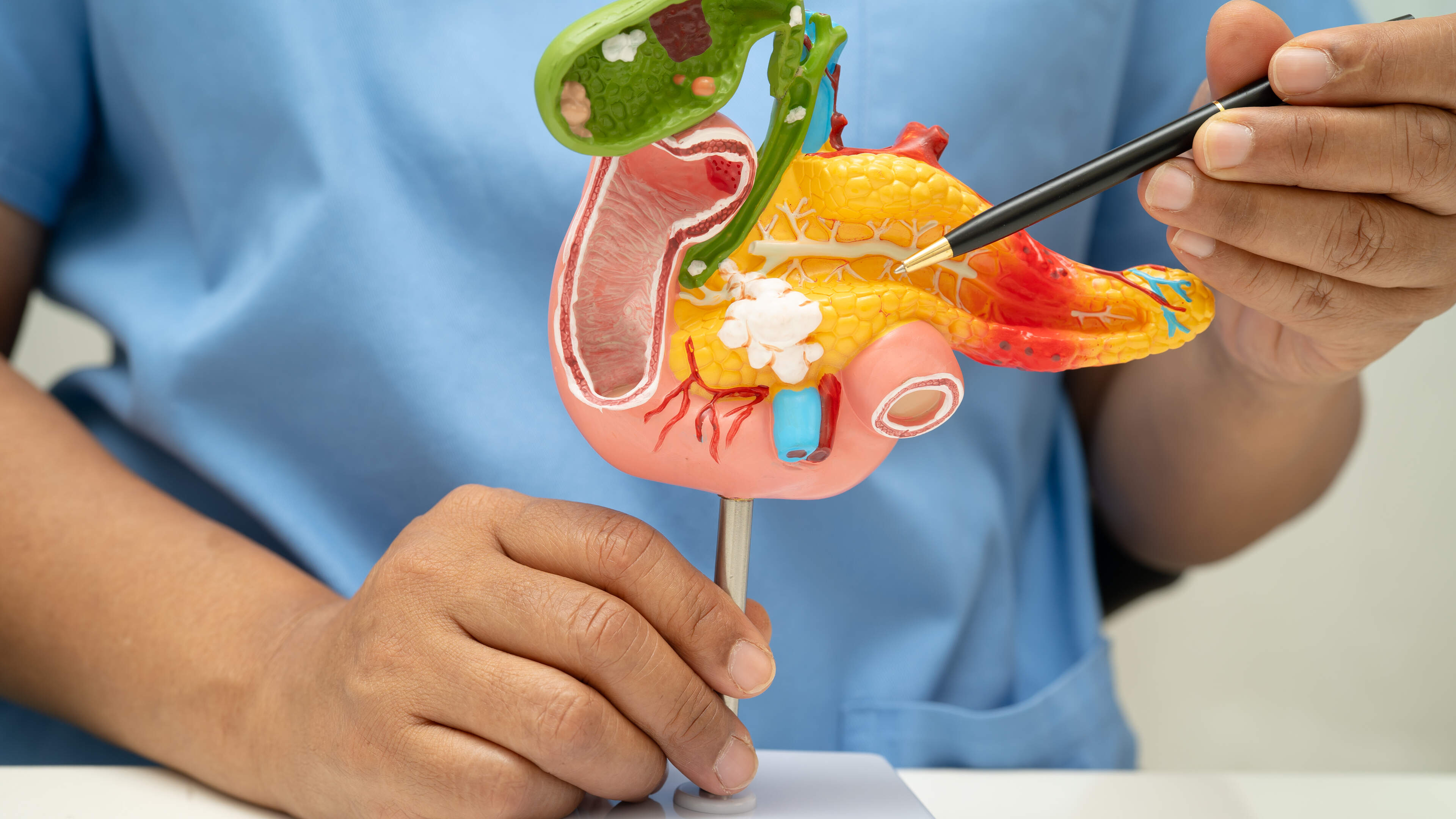 Doorbraak in onderzoek naar pancreaskanker dankzij studie VU
