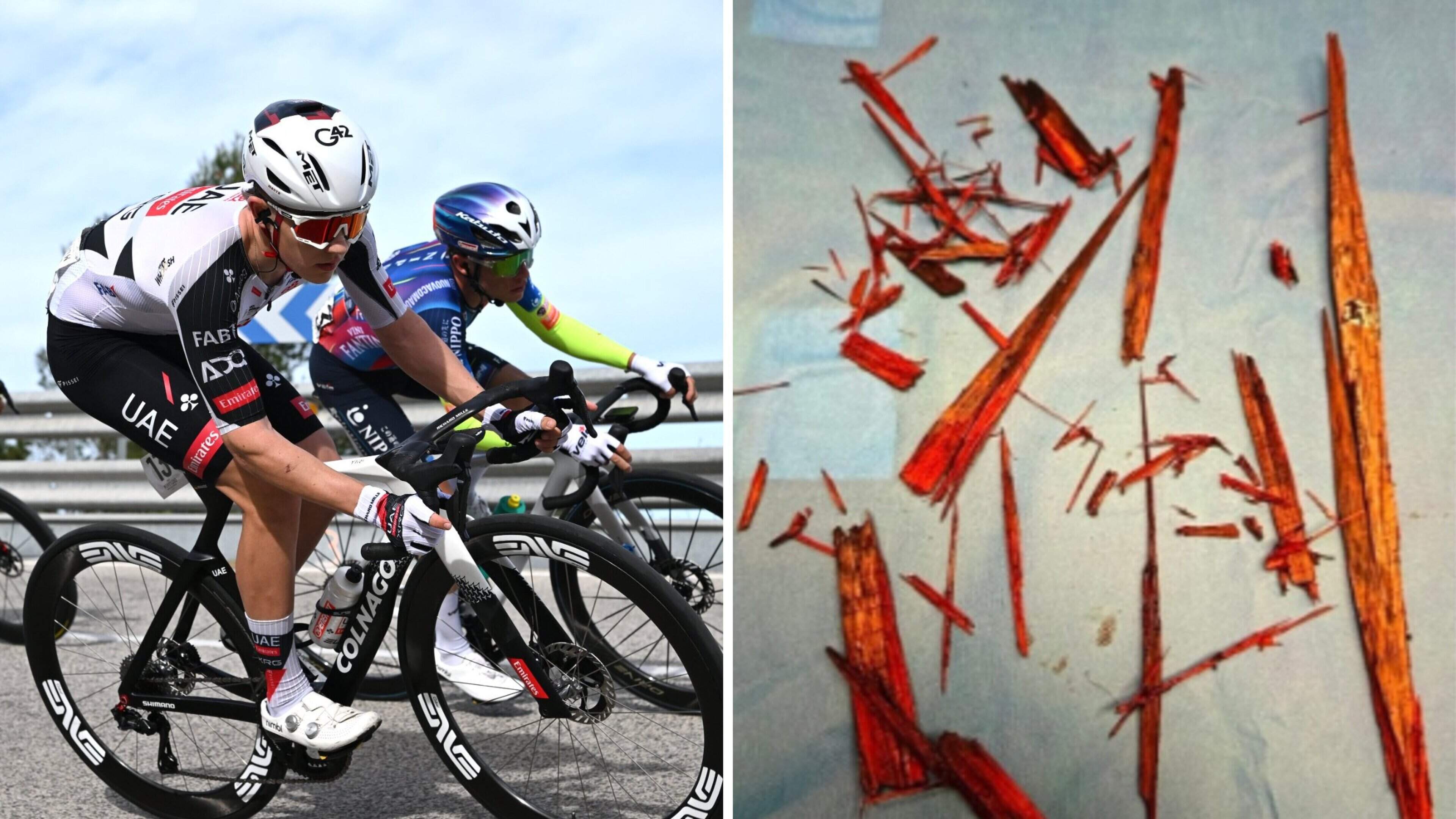 Talent (18) uit team Pogacar krijgt houtsplinter van halve meter in been: ’Dan was mijn carrière voorbij’