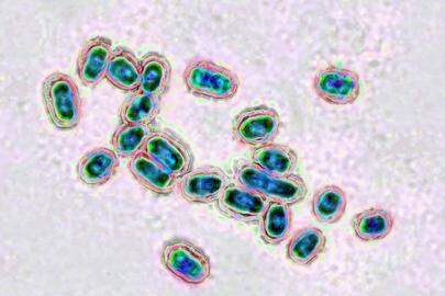 Pneumococcus (Streptococcus pneumoniae), pneumococcus is a bacteria involved in pneumonia, bronchopneumonia, purulent pleurisy, bacterial meningitis, otitis, sinusitis, and conjunctivitis. Image produced from optical microscopy. (Photo by: CAVALLINI JAMES/BSIP/Universal Images Group via Getty Images)