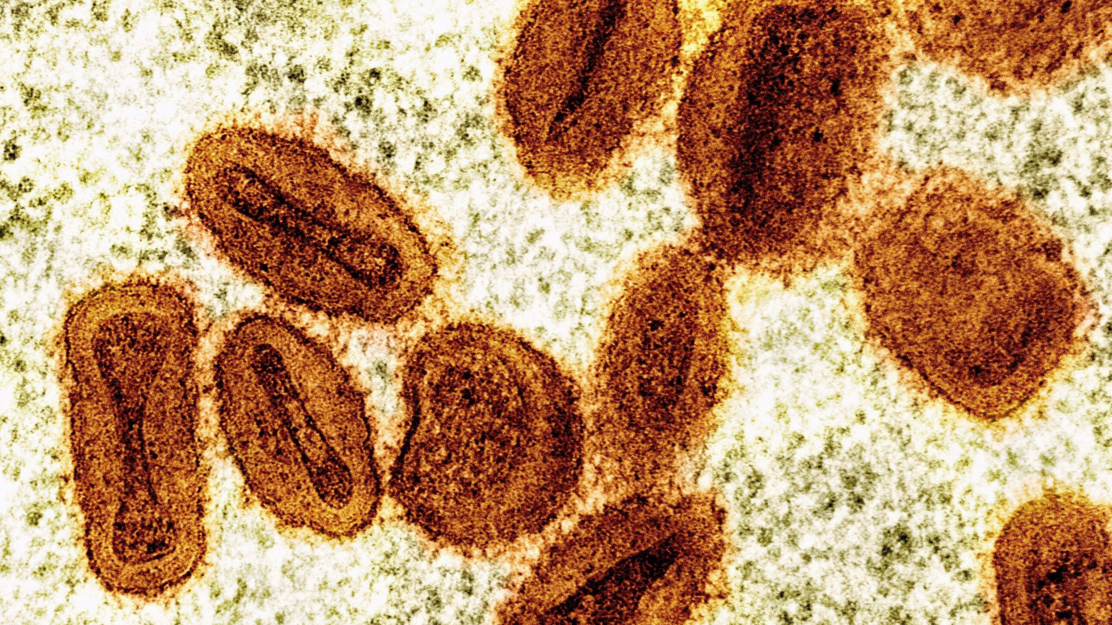 Nederlandse viroloog in VS aangeklaagd voor invoeren van ‘apenpokken’-virus