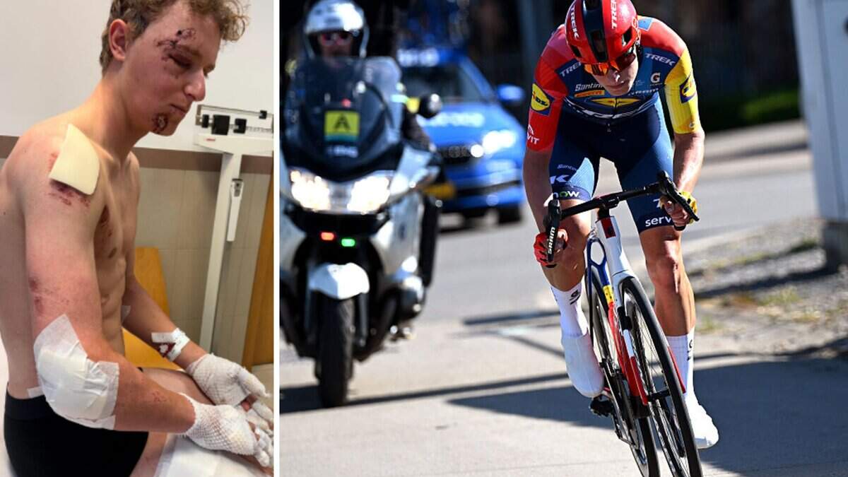 Rastalent van Lidl-Trek komt aan 80km/u ten val en deelt beelden van de ...